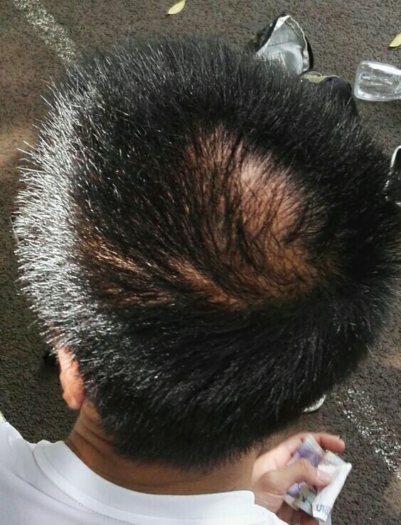 “PG国际com”特斯拉“2170”的神秘面纱或在3月揭开(图3) PG国际com